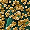 El estafilococo, primera causa de infección hospitalaria en España