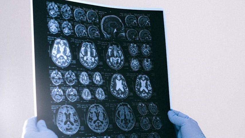 Nuevo servicio de neuropsicología en Ávila para daño cerebral y enfermedades neurodegenerativas